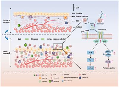 Novel insights: crosstalk with non-puerperal mastitis and immunity